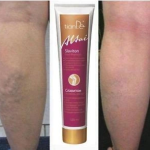 Ziołowy żel do nóg Slaviton na naczynka, żylaki, ciężkie nogi - obrazek 9